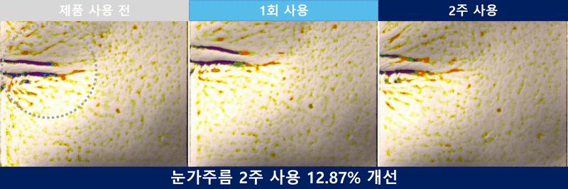 [커퍼솝] 2. 눈가주름_2주_이미지_v03_색상변경.gif