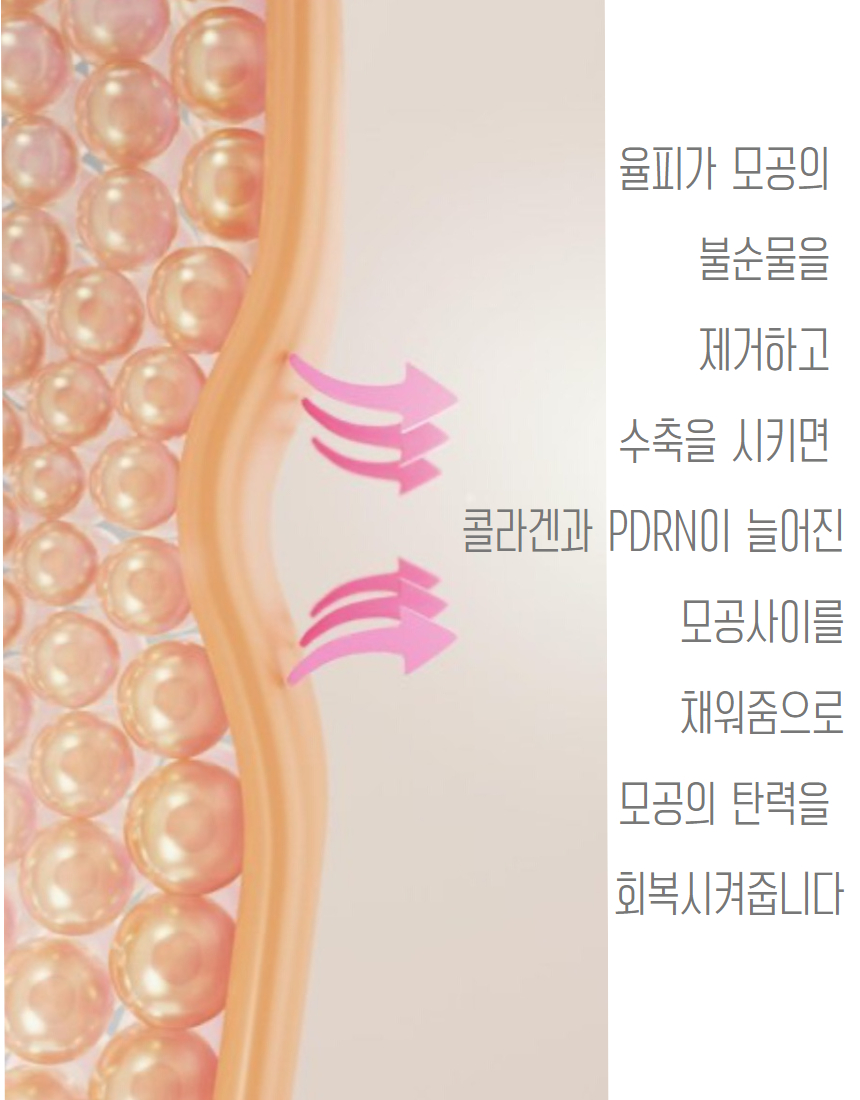 밤앰플작은탬플릿 - 2024-02-06T150351.080.jpg