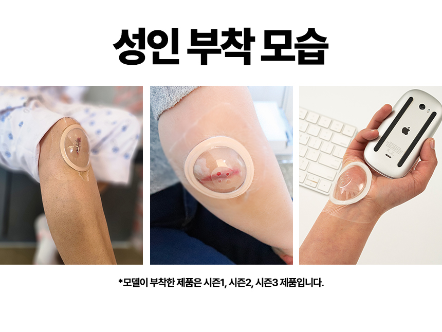 안다찌_상처보호캡-44.jpg