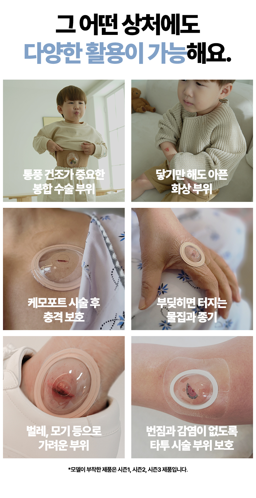 안다찌_상처보호캡-40.jpg