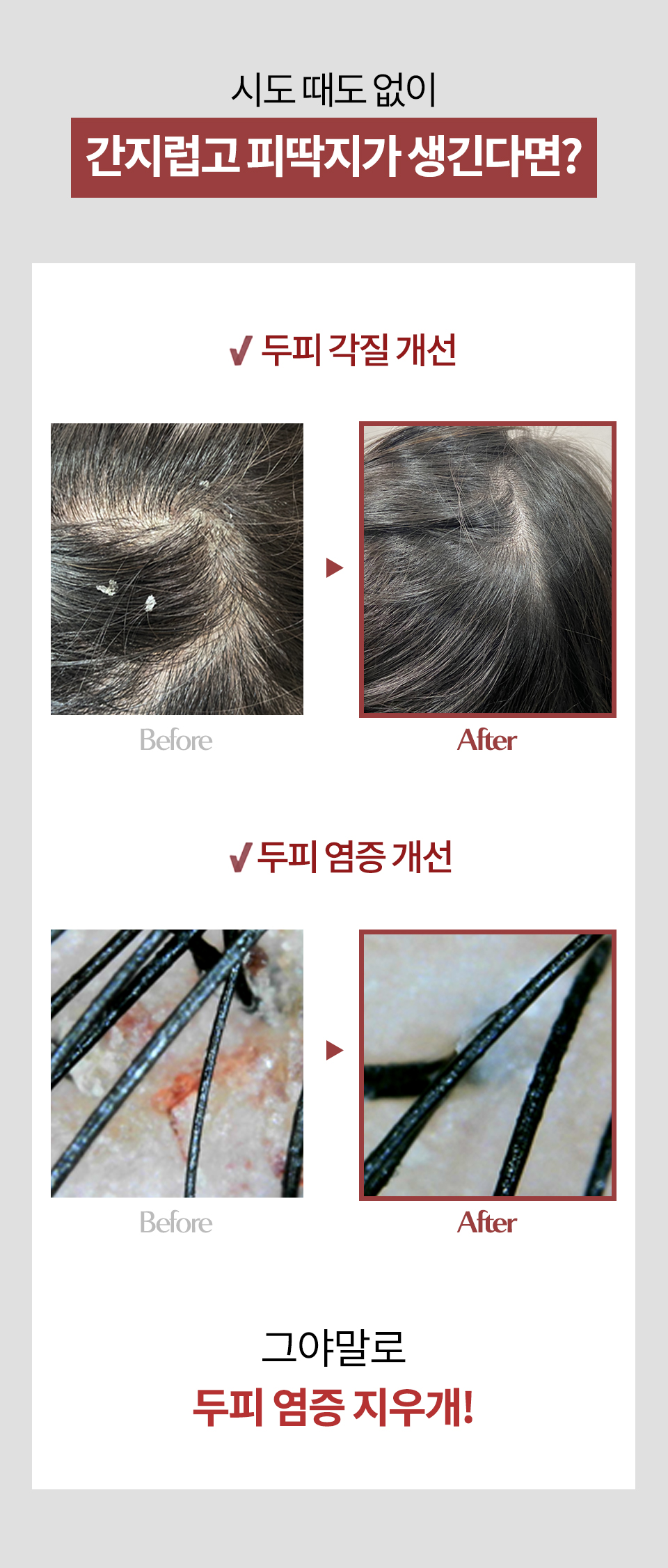 SOS-시카-상세1_06.jpg