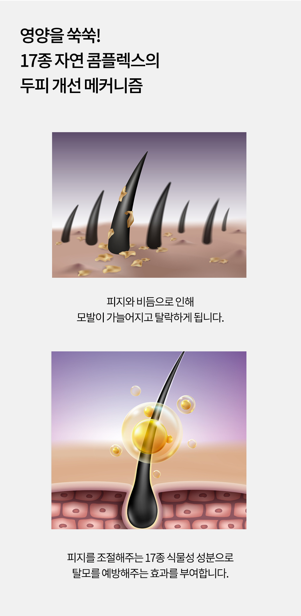 SOS-시카-상세1_11.jpg