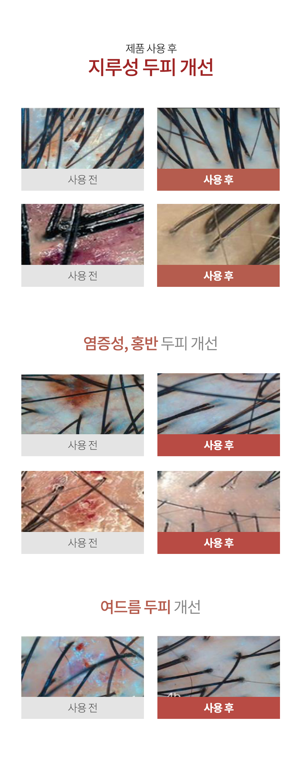 SOS-시카-상세1_12.jpg