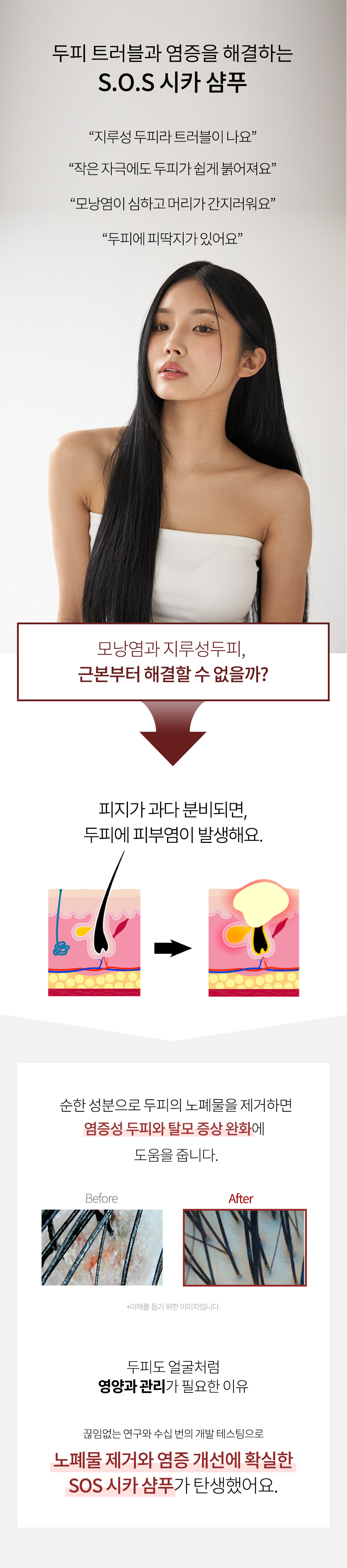 SOS-시카-상세1_05.jpg