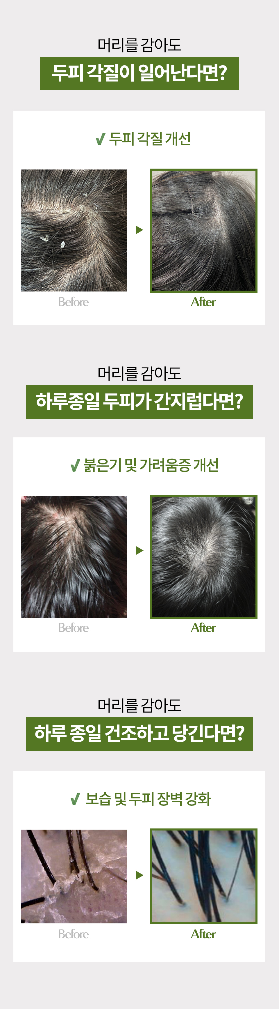 히알루로닉-알로에-상세1_06.jpg
