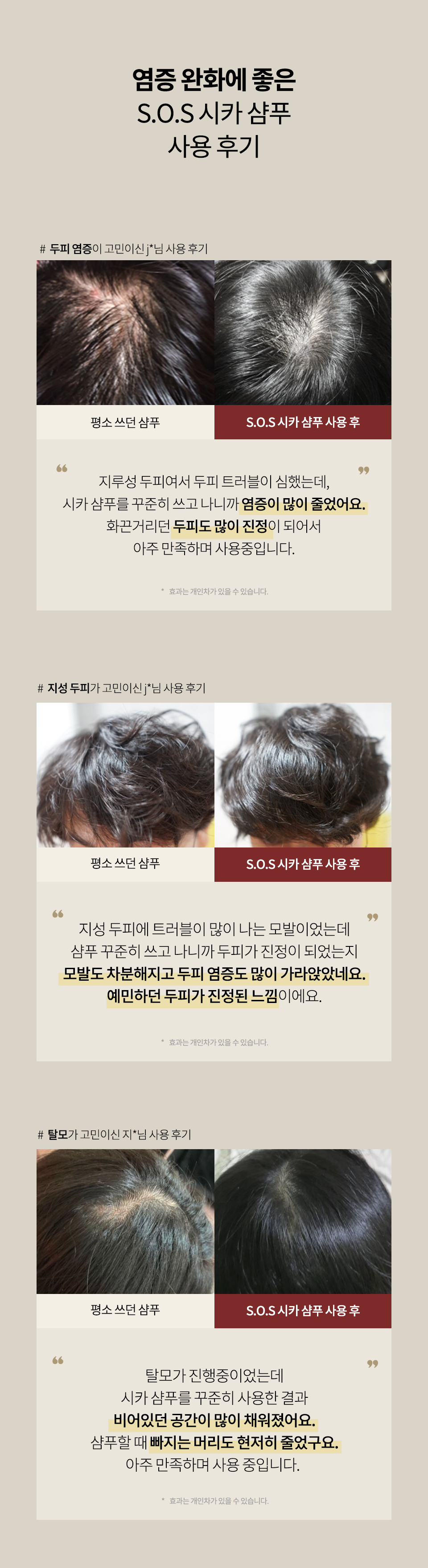 SOS-시카-상세2_08.jpg