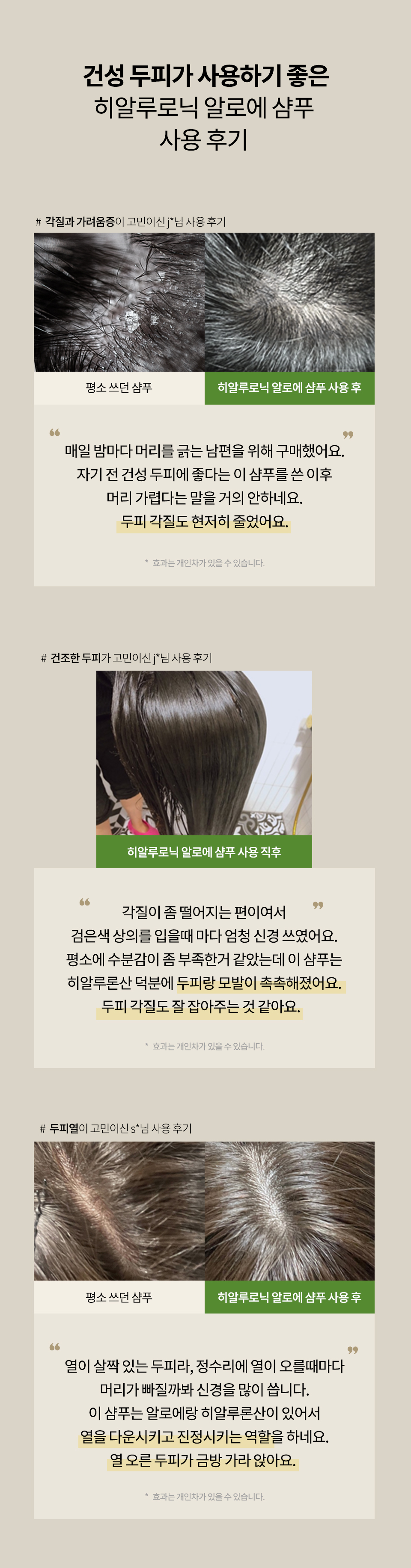 히알루로닉-알로에-상세2_02.jpg