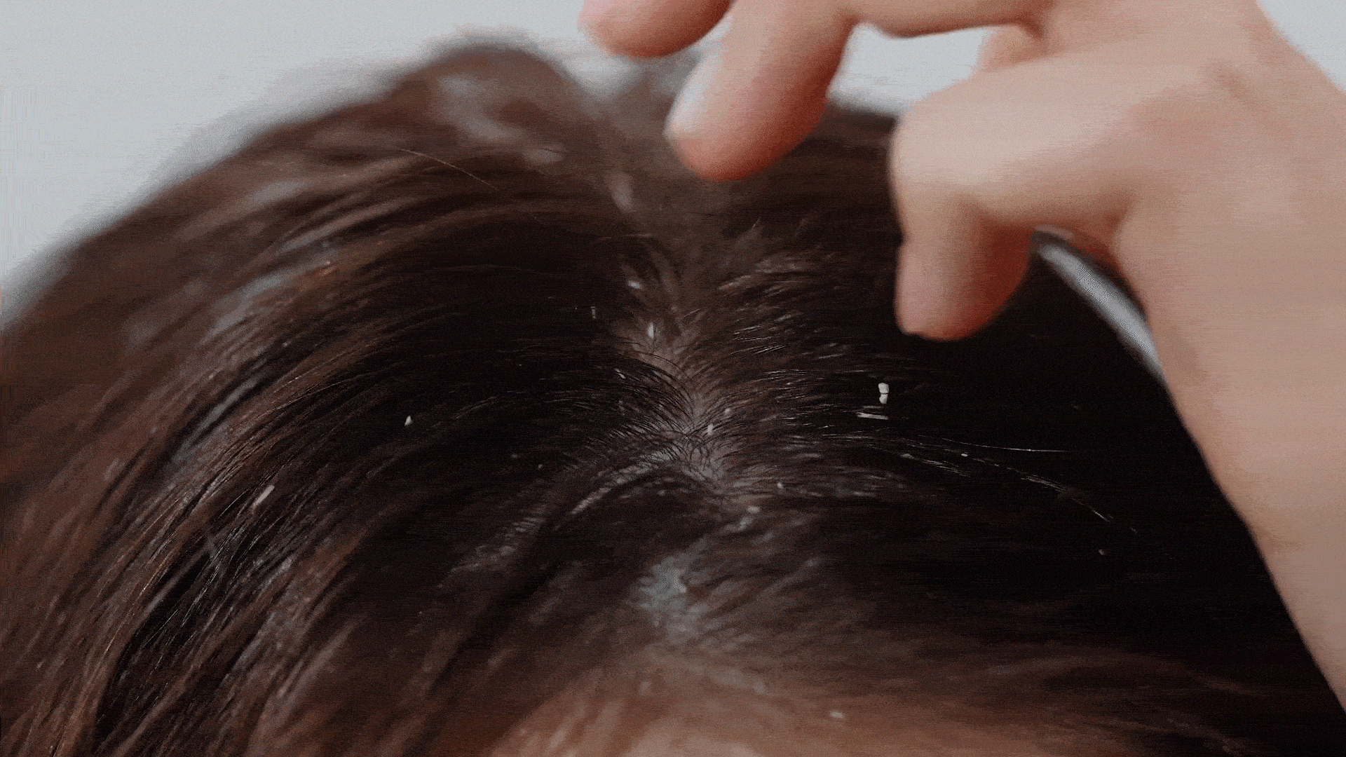 비듬.gif