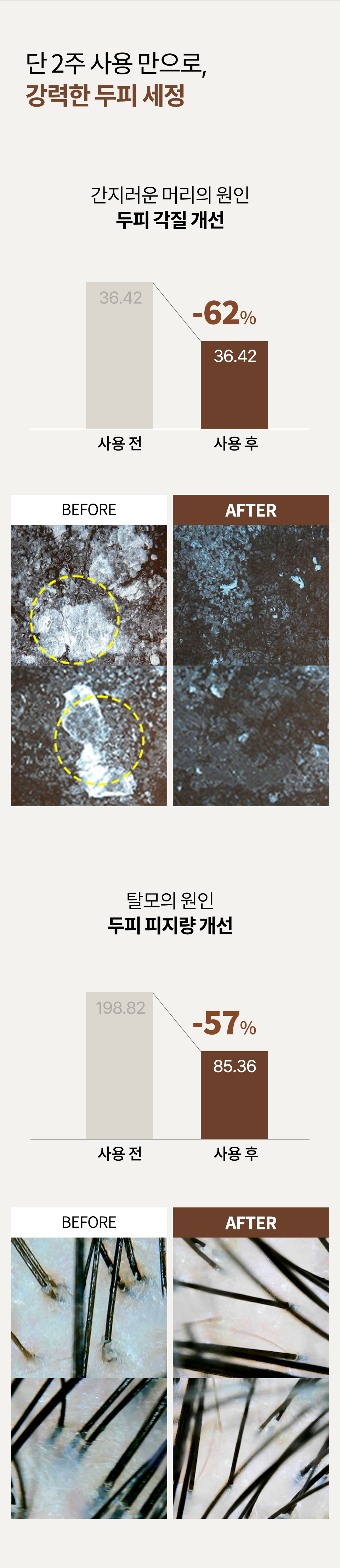 1마이크로-샴푸-상세_04.jpg